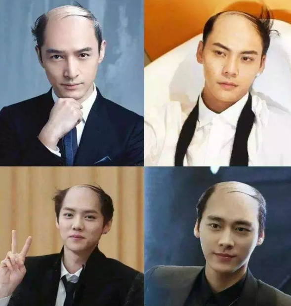 你的頭發(fā)還好嗎？