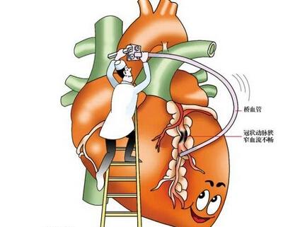 心血管疾病的心臟康復(fù)方式