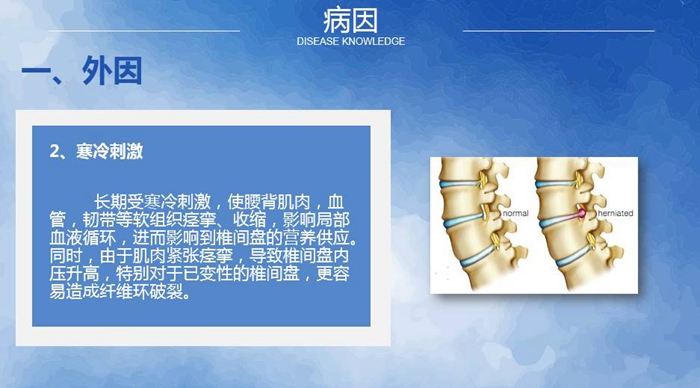 國康健康保險談腰椎間盤突出