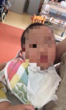 如何處理嬰幼兒發(fā)燒？這位母親的處理方式，毀了孩子的一生