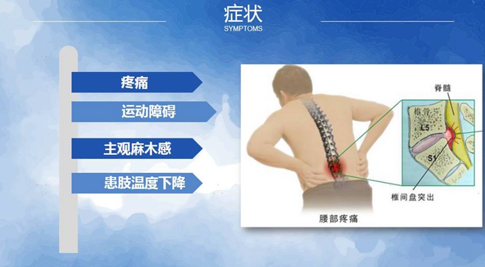 國康健康保險談腰椎間盤突出
