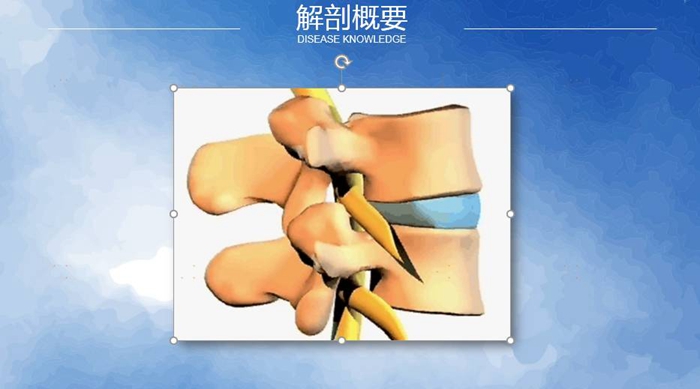 國康健康保險談腰椎間盤突出