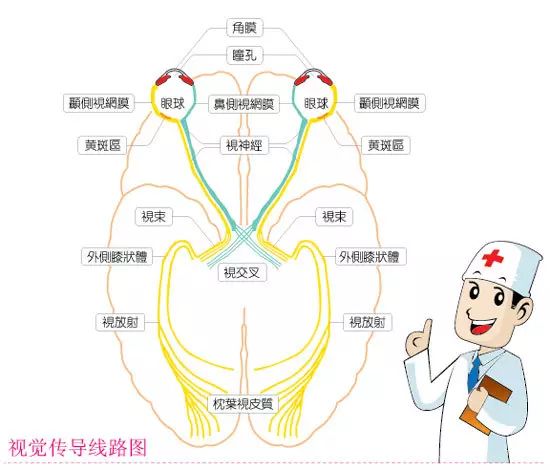 引起弱視示意圖