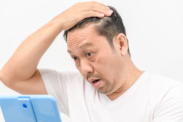 職業(yè)病科普系列一：每五個(gè)中國男性就有一個(gè)的“光明頂”！