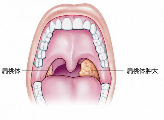 10個中國人9個口腔不健康，這些口腔知識你都知道嗎？